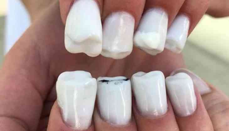 Simple Tooth Nail Art - wide 7