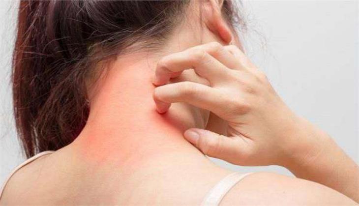 remedies to get rid of voracious
