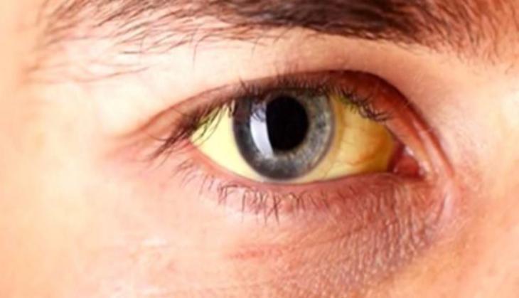 Yellow eye spots