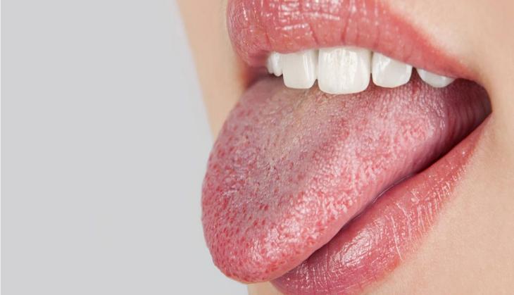 OMG! 63-year-old mysteriously gets pregnant from mouth after eating sperm in raw calamari; doctors found 12 bug emdedded in her tongue