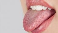 OMG! 63-year-old mysteriously gets pregnant from mouth after eating sperm in raw calamari; doctors found 12 bug emdedded in her tongue