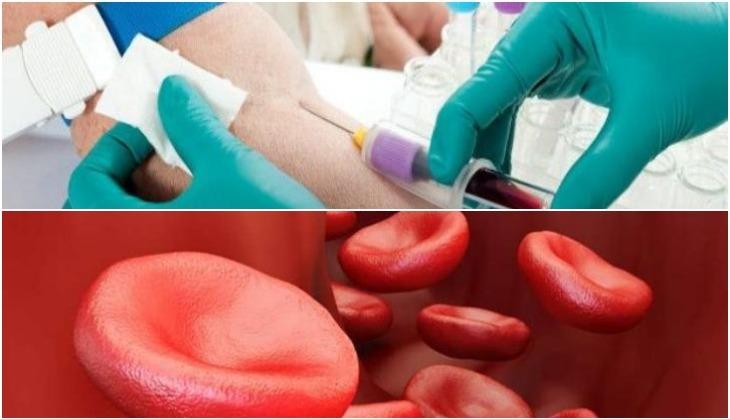 sickle cell disease
