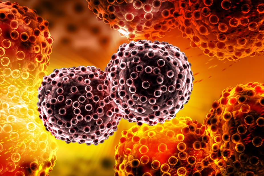 This is it! Expert reveals these foods can really cause cancer