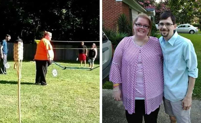 Doctors remove 50-pound watermelon-sized ovarian cyst from Alabama woman 