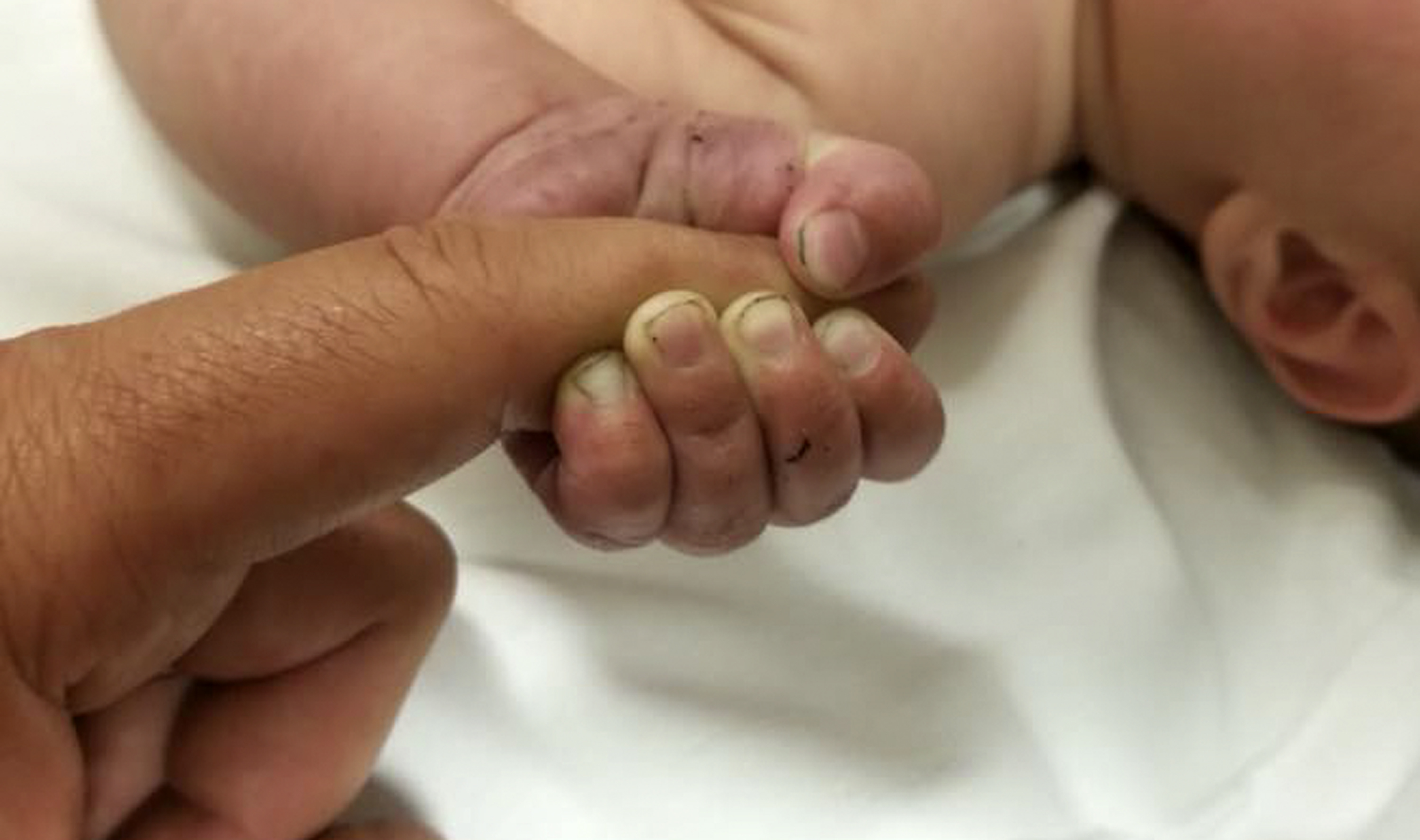 Miracle! Infant survives more than 9 hours buried alive under sticks and debris in Montana woods 