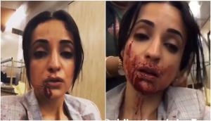 Shocking! Sanaya Irani, Zindabaad actress blames director Sidhant Sachdev for her brutal condition; shared shocking pics and videos