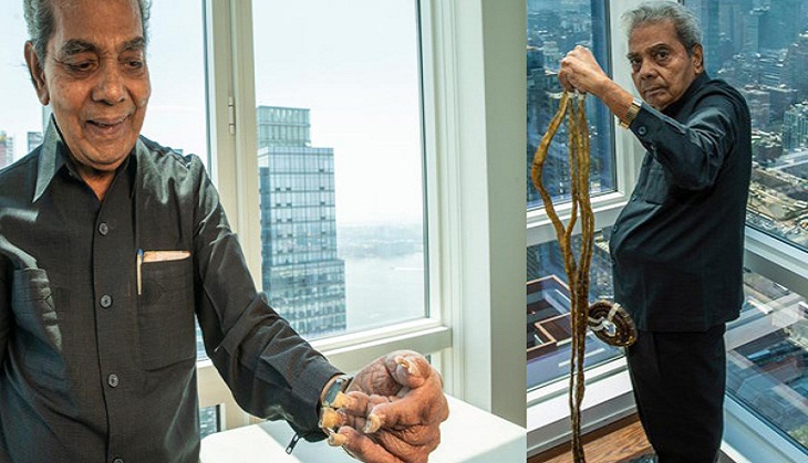 Man with world's longest nails cuts them after 66 years