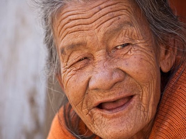 Scientists reverse aging-associated wrinkles and hair loss