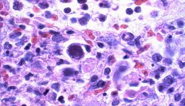 Viruses can alter human body's response to vaccines, pathogens