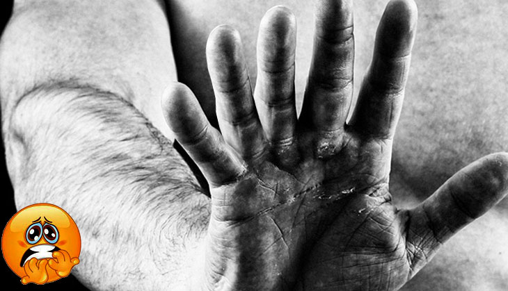 OMG! This UP boy has more than 10 fingers and 10 toes; what his relatives wanted to do with him will give you goosebumps
