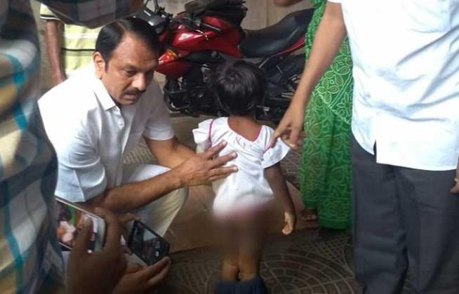 Shame! 4-year-old allegedly burnt hot spoon, tortured by mother and her live-in partner; says 'my daddy burnt me when I was eating'