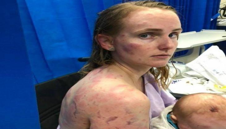 Australian Brave Mom