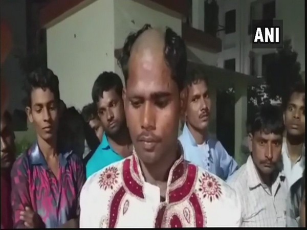 Lucknow: Groom's head tonsured after he calls off wedding over dowry