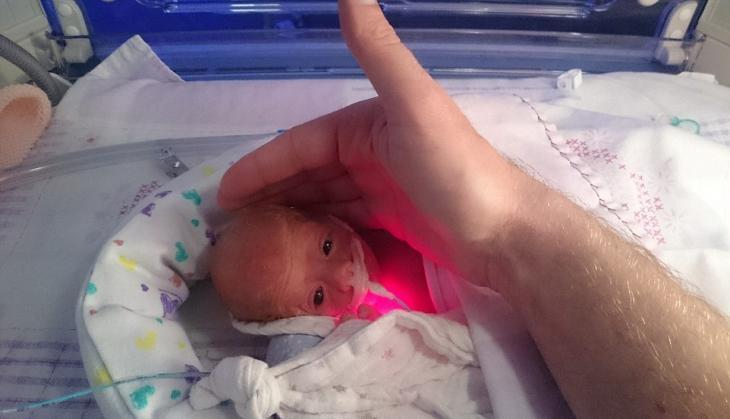 Uk Premature Baby