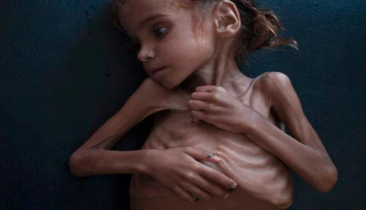 Yemen