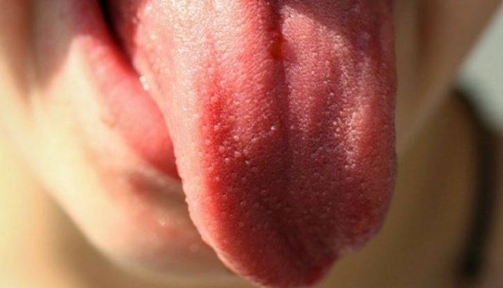 tongue