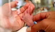 Newborn split into two during delivery: Rajasthan Human Rights panel seeks report