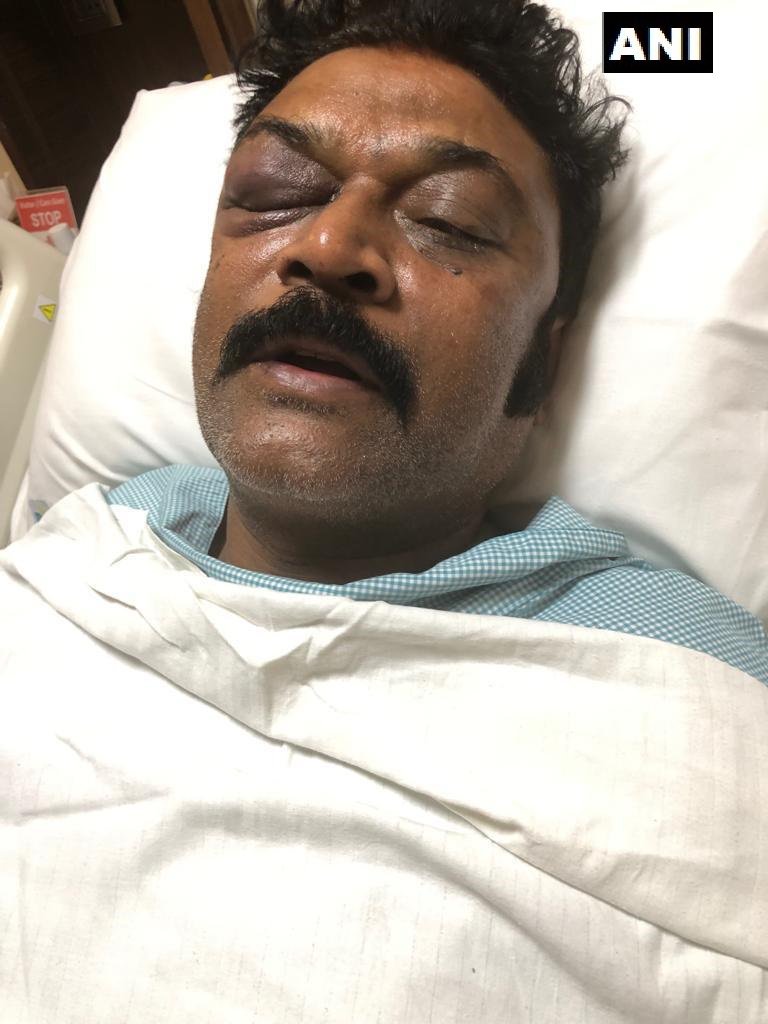 Operation Lotus 2.0: Congress gets exposed after injured MLA Anand Singh's pic goes viral; all's not well for Cong-JDS alliance in Karnataka