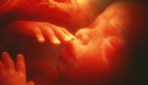 Premature born infants have delayed microbiome development