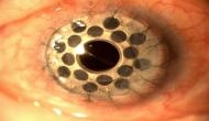 Weird! This woman has 500 holes in her eyes and the reason will give you goosebumps!