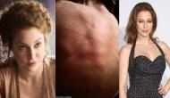 Game of Thrones 8: ‘...My night terrors’, GOT actress Esmé Bianco confesses about domestic abuse; shares disturbing pic