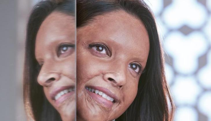 Chhapaak Trailer: Deepika Padukone, Vikrant Massey starrer’s trailer to release on this date 