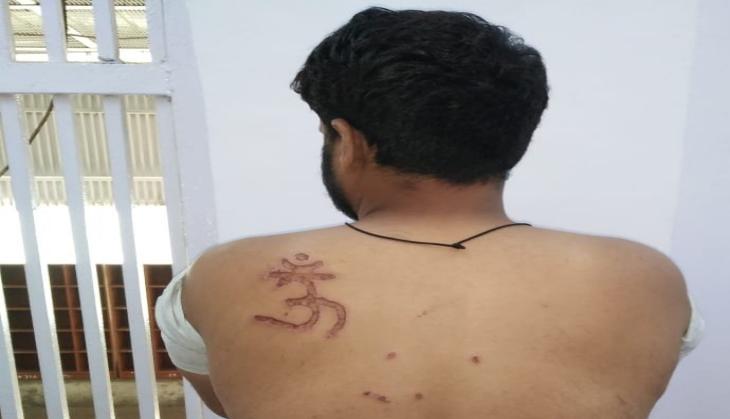 Delhi: Undertrial 'branded with Om tattoo on his back' in Tihar, inquiry underway