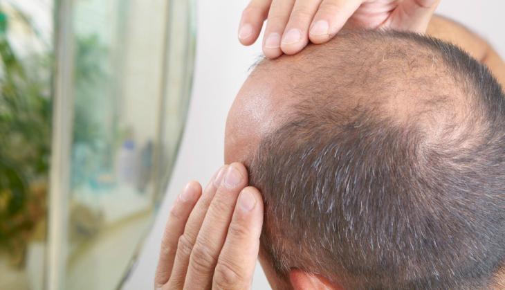 Watch how Pakistani anchor gets hilarious reply from caller while discussing problem on hair loss; video goes viral
