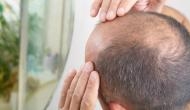 Watch how Pakistani anchor gets hilarious reply from caller while discussing problem on hair loss; video goes viral