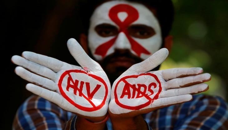HIV