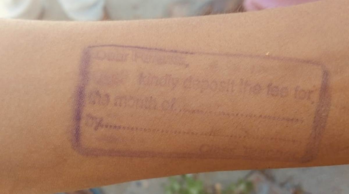Punjab: Ludhiana school stamps Class 7 student’s arm as reminder for not paying fees