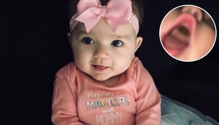 OMG! Mother panics as she finds huge black mark in her child’s mouth; you won't believe what actually it was