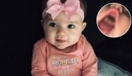 OMG! Mother panics as she finds huge black mark in her child’s mouth; you won't believe what actually it was