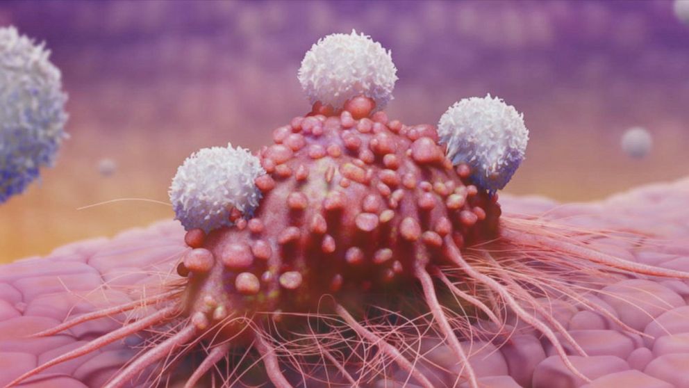 New keys found for unlocking head, neck cancer treatment