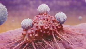 New keys found for unlocking head, neck cancer treatment