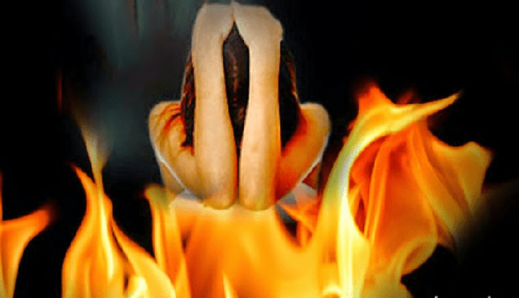 woman burned