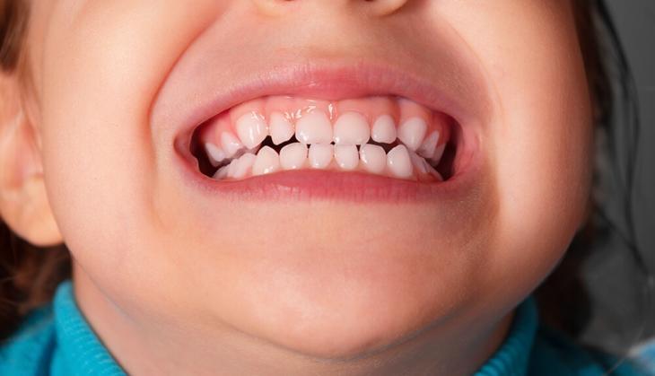 Teeth