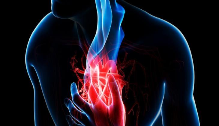cardiac arrest