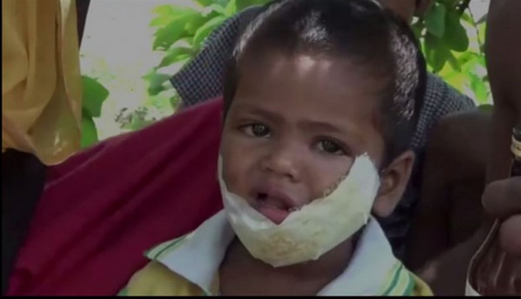 Haryana: Man sells phone for daughter's treatment after govt hospital runs out of anti-rabies vaccine