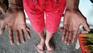 Madhya Pradesh: This family members have 12 fingers in hand and feet