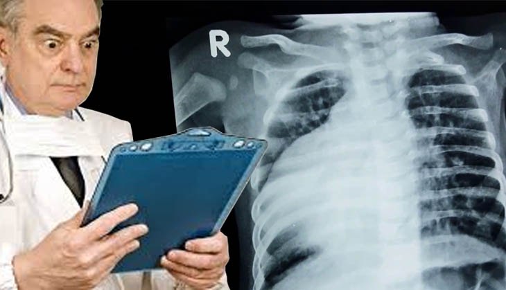 What! UP man has heart on right, liver on left; his x-ray, ultrasound reports will blow your fuse!