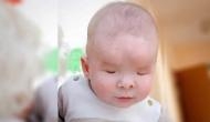 Mother abandons baby boy who born without eyeballs; pictures of munchkin will melt your heart!