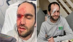 Shocking! Motorcyclist permanently loses eyesight after egg thrown from oncoming car [PIC]