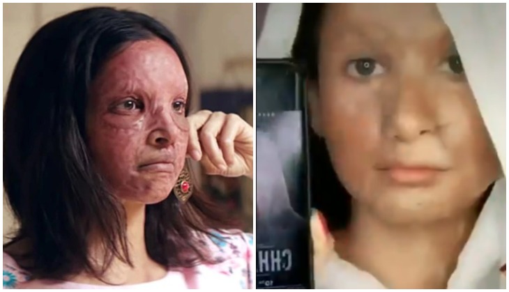Chhapaak actress Deepika Padukone gives acid attack look challenge on TikTok; gets brutally trolled