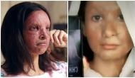Chhapaak actress Deepika Padukone gives acid attack look challenge on TikTok; gets brutally trolled