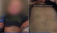 Nursery teacher gets fired for writing message on student’s stomach; know the bizarre reason