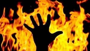 Man pours turpentine oil over his son, sets him ablaze for 'beedis'