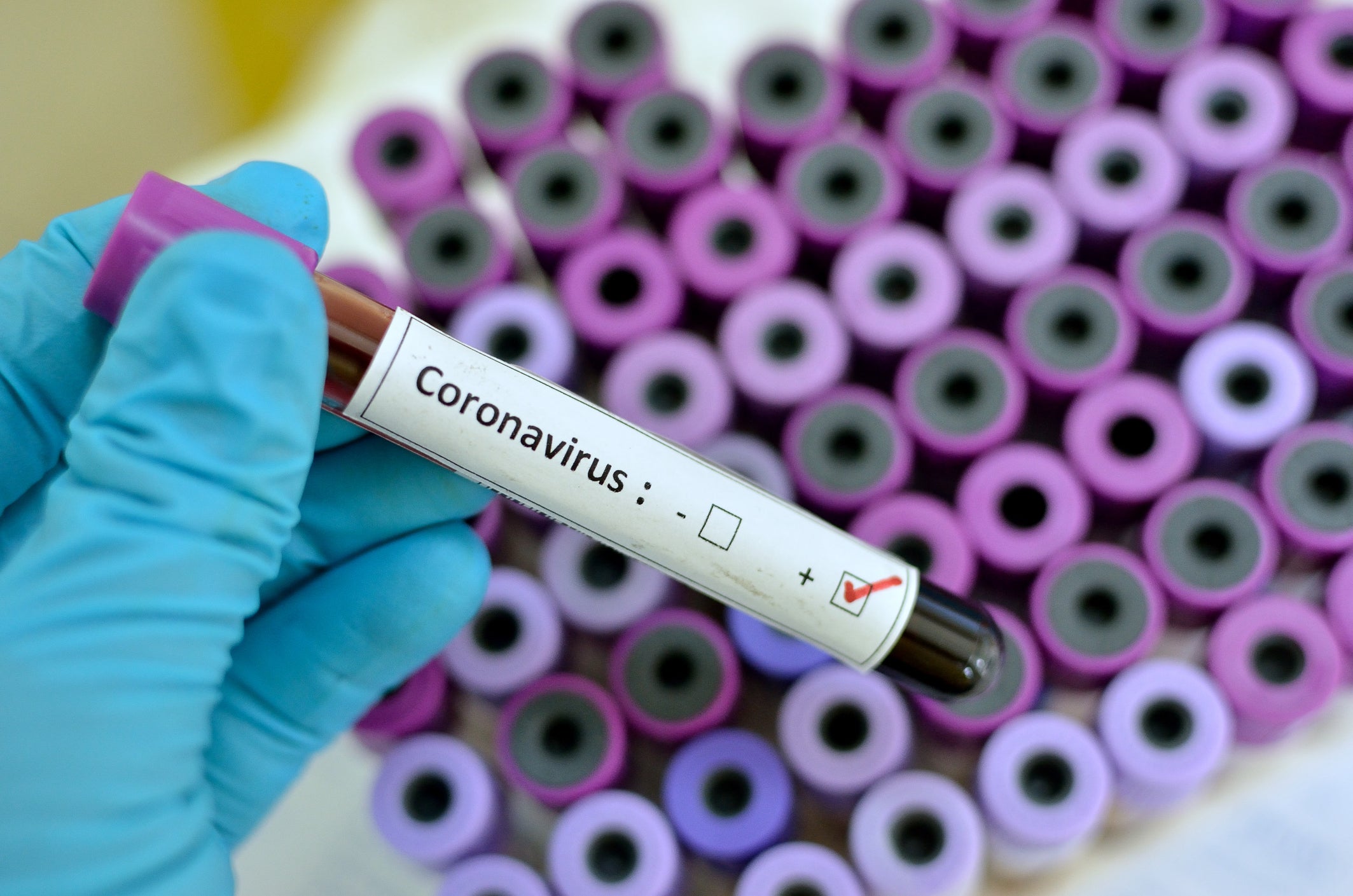 Coronavirus: Delhi man who was diagnosed with infection recovers, narrates his experience