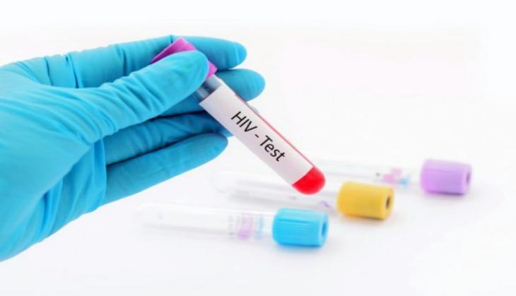 HIV