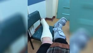 Oh No! Mom breaks both of her ankles while attempting popular TikTok dance challenge